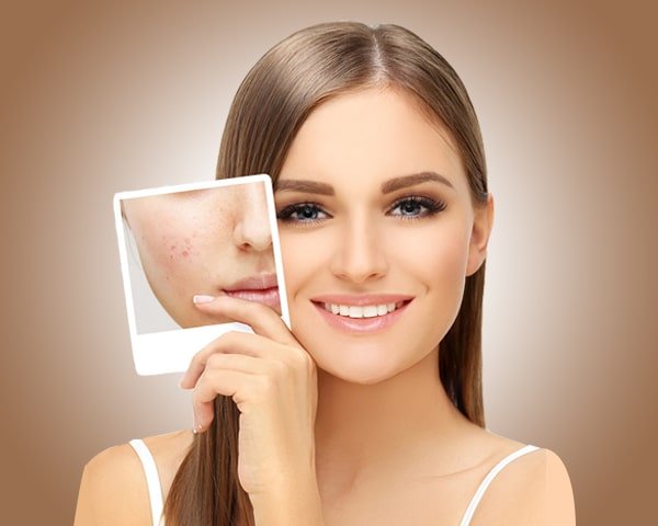 Skin Care Treatment 3 jdwdw |